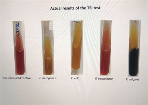 enterobacter aerogenes test results